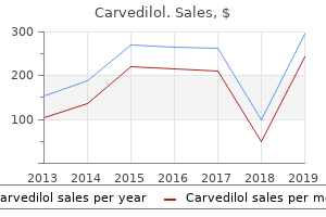 purchase carvedilol with amex