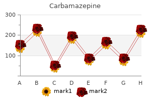 buy carbamazepine on line