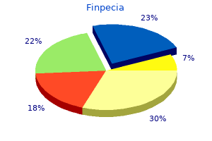 cheap finpecia 1mg mastercard